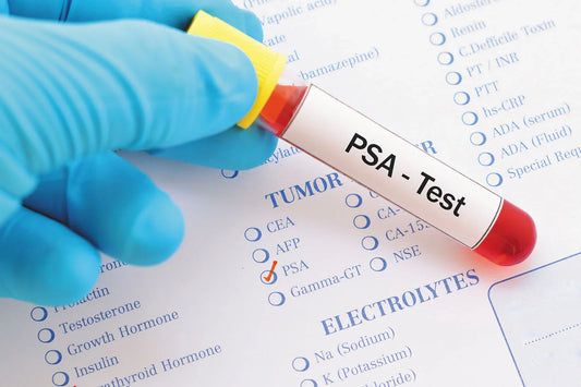 🩺 How Often Should You Take a PSA Test?