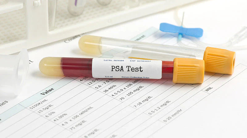 🧪 How to Use a PSA Rapid Test at Home (Step-by-Step Guide)